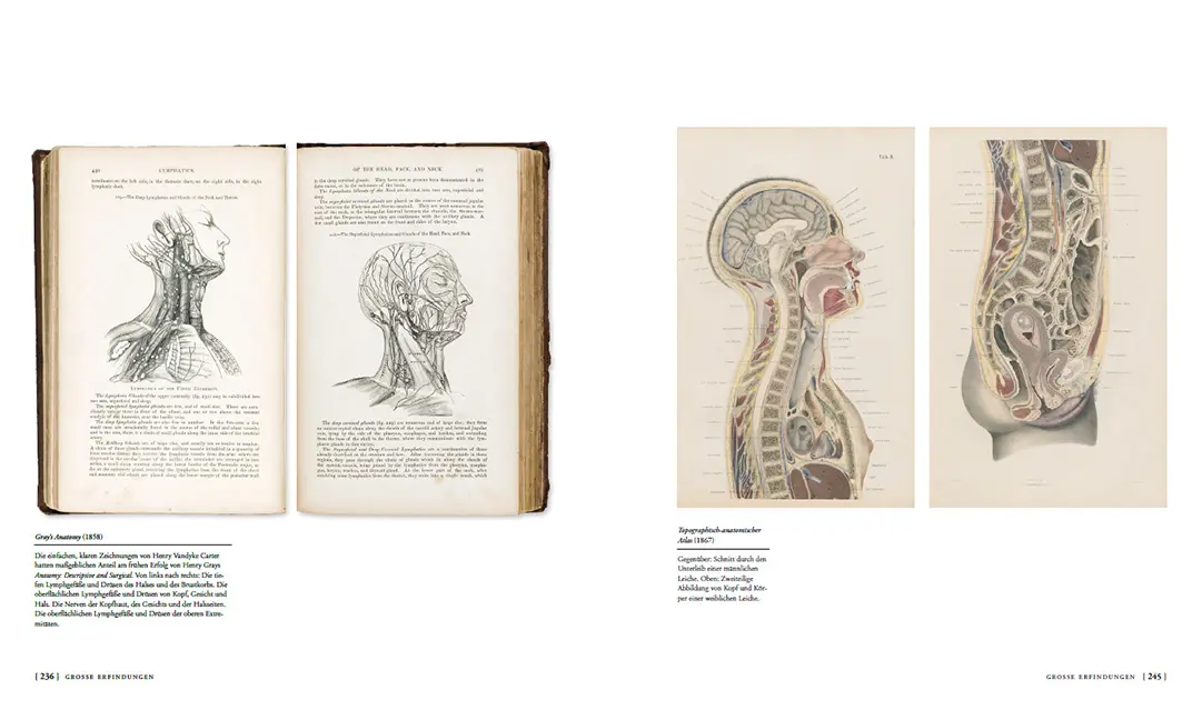 Beispielinhalt (Bild) Die Geschichte der Anatomie
